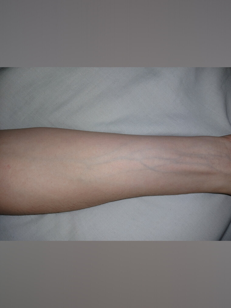 Only Veins banner image