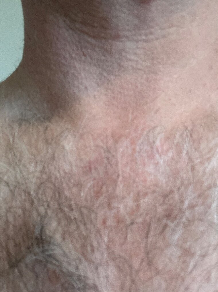 ZorroHairyBearOZ cover image